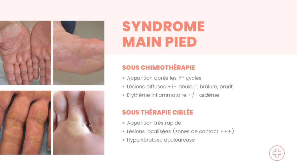 Oncologie 4 - Epitop Pharmacie